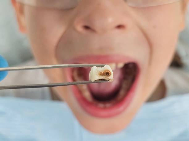 Best After-Hours Dental Trauma Care in Louisiana, MO